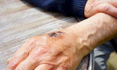 Sui presunti maltrattamenti alla Rsa c’è un’altra verità: “Eravamo provati, ma nessuna violenza”