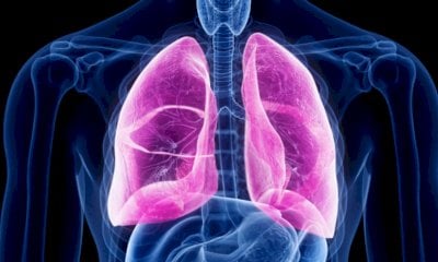 Bra aderisce alla Settimana di sensibilizzazione sul test del portatore sano di fibrosi cistica