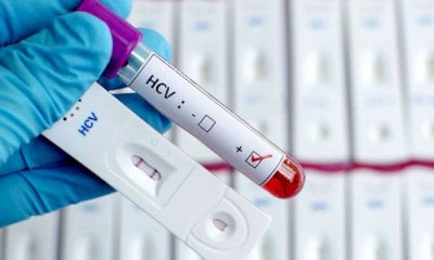 Epatite C, screening gratuito prorogato per tutto il 2026