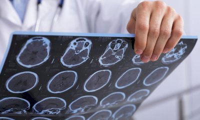 Chi è il neurochirurgo e quando entra in gioco? A Cuneo un incontro aperto al pubblico