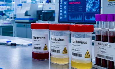 Hantavirus, la Regione diffonde la circolare del Ministero della Salute: "Al momento nessun allarme"