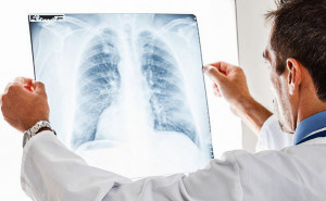 Ad Alba un congresso dedicato alle malattie polmonari