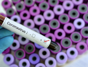Coronavirus, il numero dei morti in Piemonte sale a 133, nella Granda sono 7