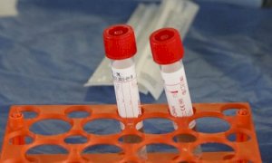 Coronavirus, in Piemonte dodici nuovi laboratori per i test