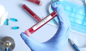 Coronavirus, oggi in Piemonte settanta decessi: cinque in provincia di Cuneo