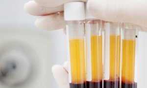 Coronavirus, anche in Piemonte si sta utilizzando la cura con il plasma