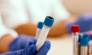 In Piemonte tamponi garantiti anche per i privati che risultano positivi ai test sierologici