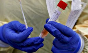Coronavirus, il bollettino di venerdì 12 giugno: nella Granda 3 nuovi casi e 19 guariti, nessun nuovo decesso