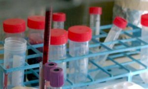 Coronavirus, negli ultimi dieci giorni un solo decesso in provincia di Cuneo