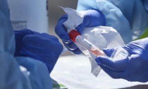 Coronavirus, in Piemonte restano 10 pazienti in terapia intensiva