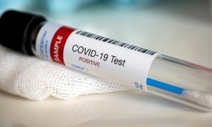 Coronavirus, il bollettino di martedì 7 luglio: tutti asintomatici i nuovi casi registrati in Piemonte