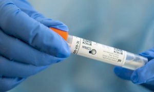 Coronavirus, il bollettino di giovedì 9 luglio: nella Granda un nuovo caso, fermi i decessi