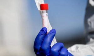 Coronavirus, 'doppio zero' nella Granda: nessun nuovo caso e nessun decesso nelle ultime 24 ore