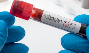 Coronavirus, da un mese in provincia di Cuneo non si registrano decessi