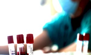 Coronavirus, in Piemonte i ricoveri tornano a scendere