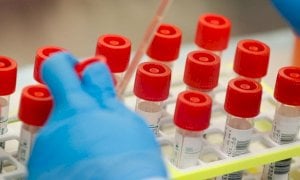 Coronavirus, 60 nuovi casi registrati in Piemonte nelle ultime 24 ore