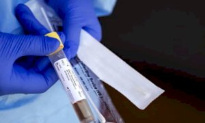 Coronavirus, i dati del 2 settembre: un terzo dei nuovi casi del Piemonte è importato