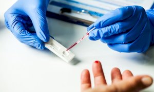Test sierologici per gli insegnanti, i primi dati di adesione nel territorio dell'Asl CN1