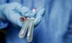 Coronavirus, i positivi nei reparti di terapia intensiva del Piemonte restano stabili