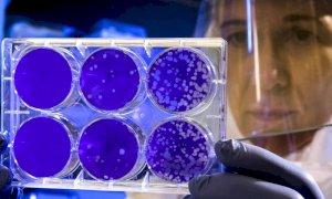 Coronavirus, in arrivo in Piemonte un milione di test salivari