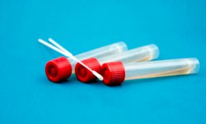 Tampone obbligatorio per chi rientra dalle zone a rischio della Francia: le indicazioni per il Piemonte