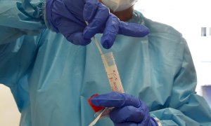 Coronavirus, i dati di lunedì 5 ottobre: in Piemonte salgono i ricoveri