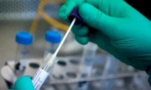 Coronavirus, in Piemonte i ricoveri in terapia intensiva passati da 22 a 30 in 24 ore