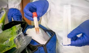 Coronavirus, nella Granda 99 nuovi casi e un nuovo decesso