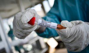 Coronavirus, per casi testati e percentuale di positività il Piemonte tra le peggiori regioni d'Italia