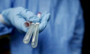 Coronavirus, in Piemonte 1.123 nuovi casi (687 asintomatici)