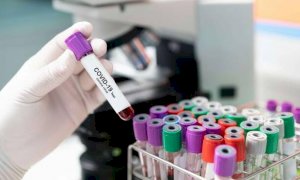 Coronavirus, i positivi ricoverati in Piemonte superano quota mille