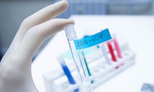 Coronavirus, i dati di domenica 1° novembre: in Piemonte 2.024 nuovi casi