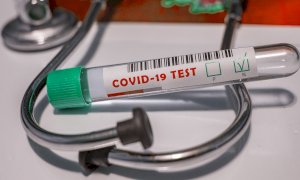 Coronavirus, test molecolari volontari agli over 65enni asintomatici affetti da malattie croniche