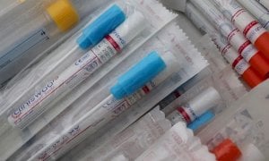 Coronavirus, tasso di positività al 6,8% in Piemonte. Oggi altri 84 decessi