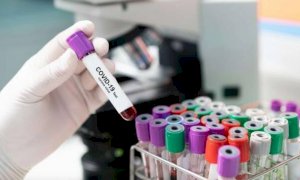 Nel secondo giorno di zona gialla scendono i ricoveri per Covid-19