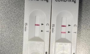 Test rapidi gratuiti, partito il progetto 'Natale sicuro' per gli over 65 con patologie croniche