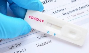 Coronavirus, test rapidi a prezzo scontato per i residenti a Cherasco