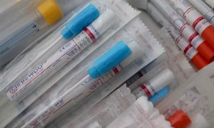 ''In Piemonte un'alta percentuale di ricoveri in relazione ai positivi al Covid: ecco perché''