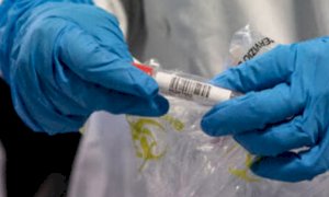 Coronavirus, in Piemonte accertati 821 nuovi casi: 363 sono asintomatici