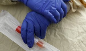 Coronavirus, il bollettino di venerdì 5 marzo: la situazione in Piemonte