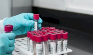 Dalla Regione dieci milioni di euro per progetti di ricerca anti Covid