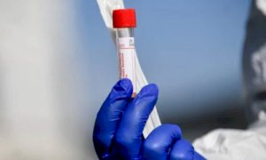 Coronavirus, Piemonte: il bollettino di domenica 2 maggio