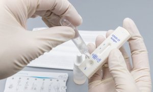 Test rapidi per il Green Pass a prezzi agevolati: in Piemonte hanno già aderito 200 farmacie