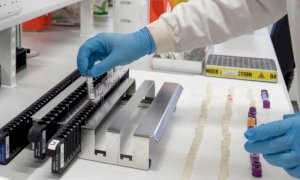 Coronavirus, Piemonte: il bollettino di martedì 21 settembre