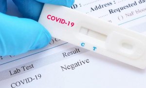 Coronavirus, minime variazioni nei ricoveri. Il Piemonte registra otto nuovi decessi