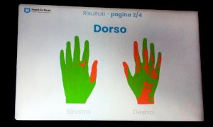 All'ospedale di Verduno un nuovo scanner digitale per valutare l'igiene delle mani