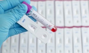 Epatite C, attivo in tutto il Piemonte lo screening per la ricerca del virus