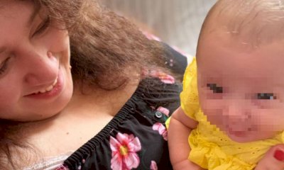 Mamma 43enne partorisce dopo una gravidanza con utero erniato: solo 16 casi analoghi al mondo
