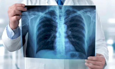 L'Asl CN2 potenzia le prestazioni di Radiodiagnostica